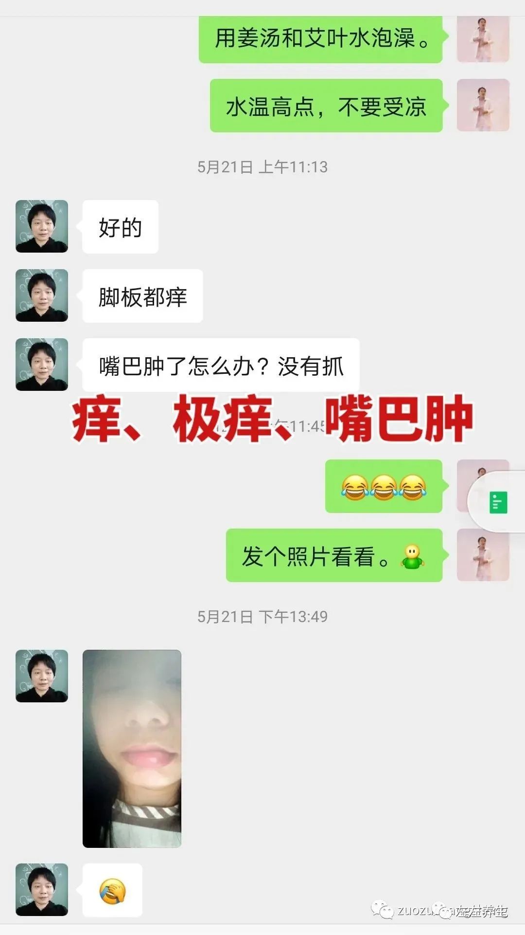 案例分享：调理荨麻疹的好转反应