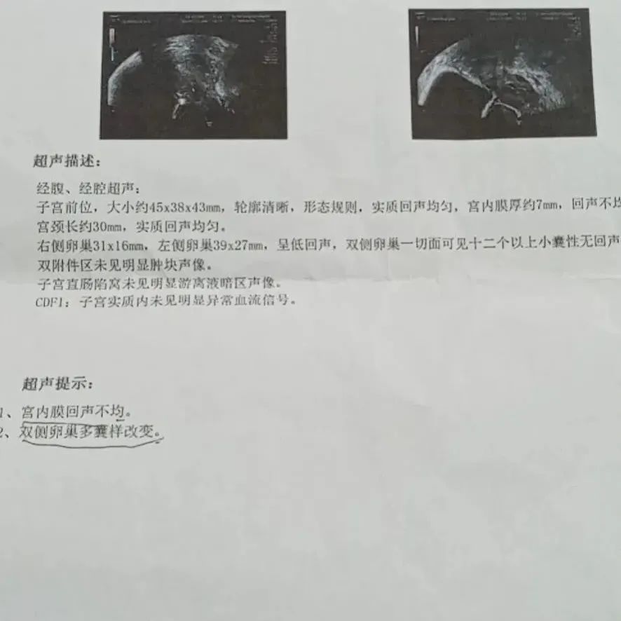 案例分享：多囊卵巢综合征与月经长达三个月的案例-原始点全球同学网