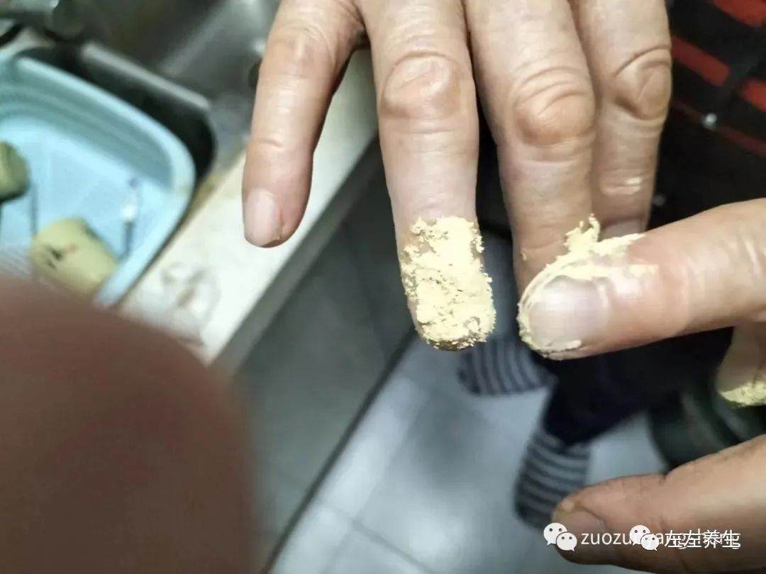 案例分享:手指夹伤后血流不止调理案例 案例分享:手指夹伤后血流不止调理案例