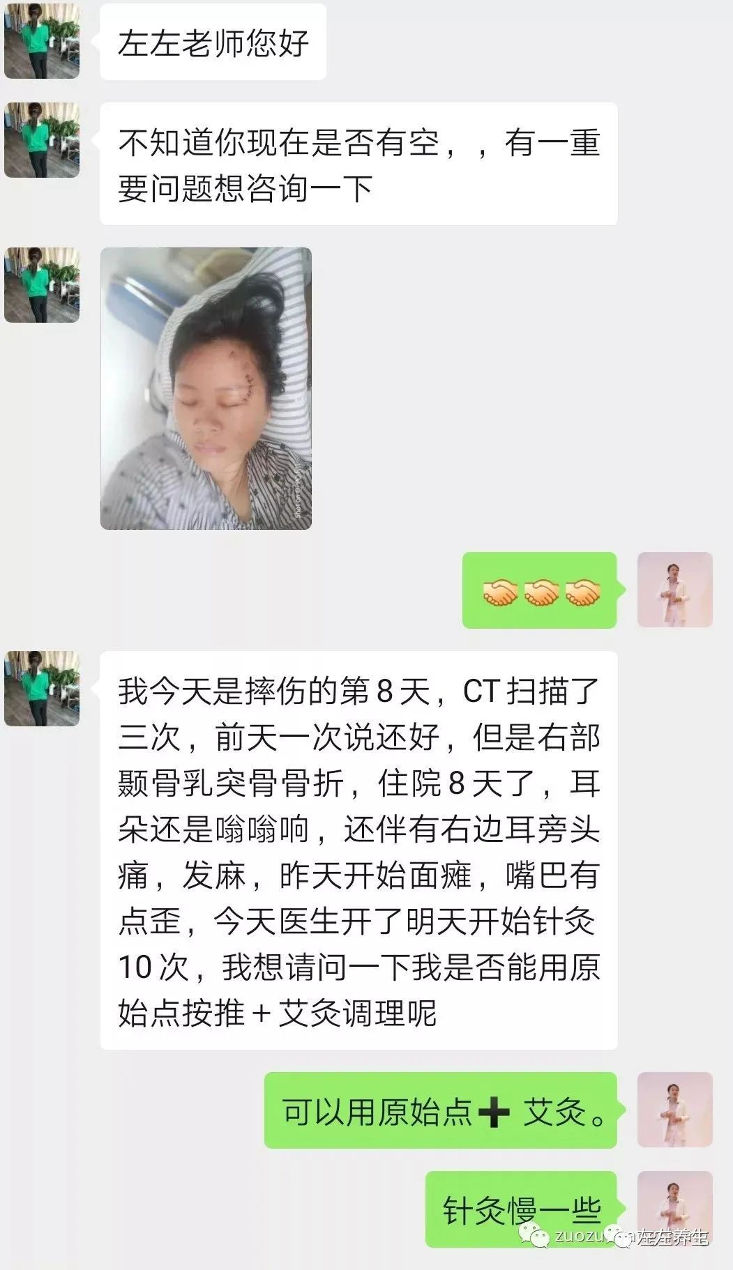 案例分享:车祸导致面瘫调理案例 案例分享:车祸导致面瘫调理案例