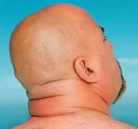 西医无法解释的真相,这里终于说透了(收藏) 西医无法解释的真相,这里终于说透了(收藏)