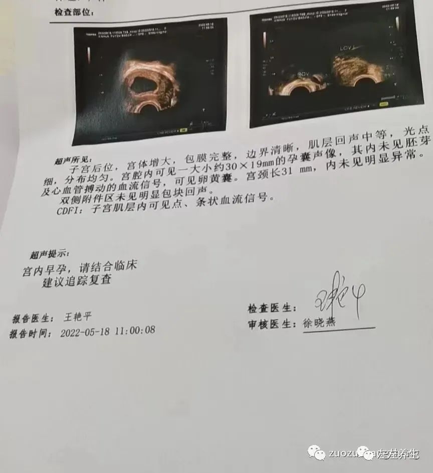 案例分享：胎停排死胎调理案例