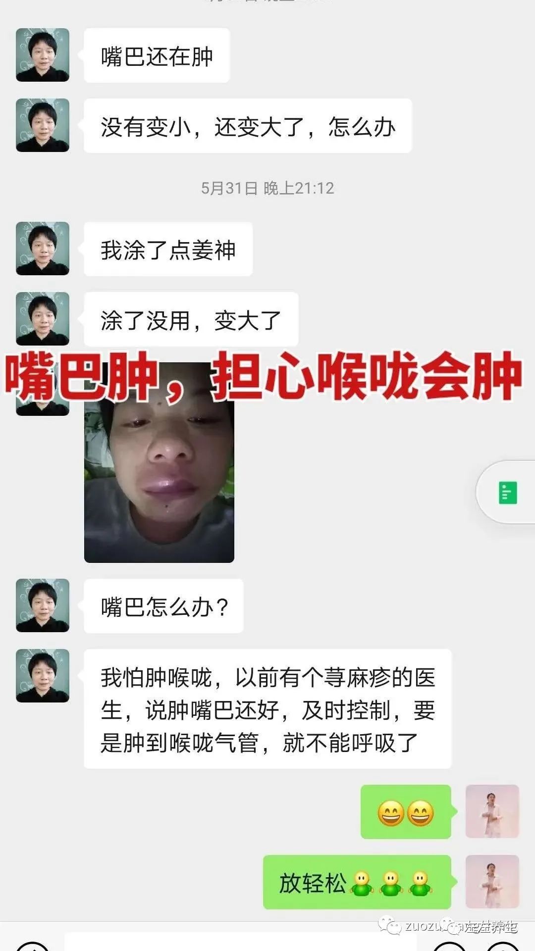 案例分享：调理荨麻疹的好转反应