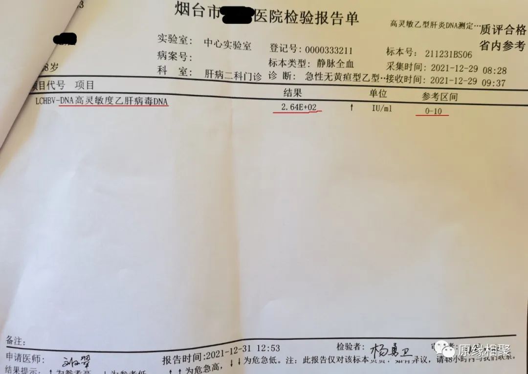 急性乙肝病毒 急性乙肝病毒