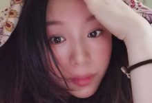 案例分享:左左剧烈、持续神经性偏头痛调理案例-原始点全球同学网