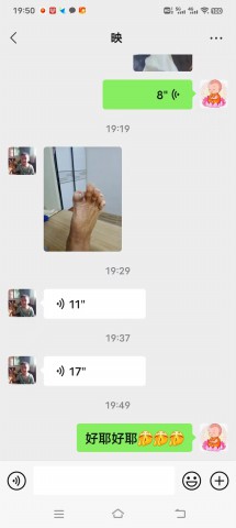 糖尿病脚趾头腐烂后脱落 糖尿病脚趾头腐烂后脱落