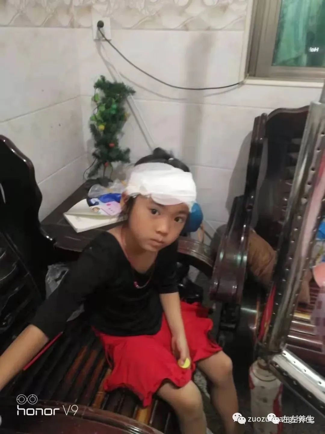 案例分享:小孩毛囊炎反复发作调理案例 案例分享:小孩毛囊炎反复发作调理案例