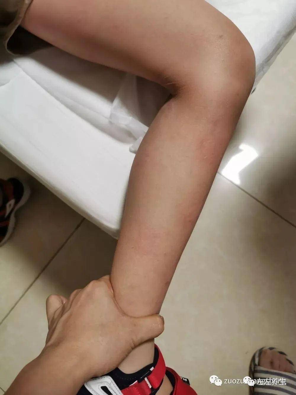 案例分享:突发性过敏全身痒调理案例 案例分享:突发性过敏全身痒调理案例
