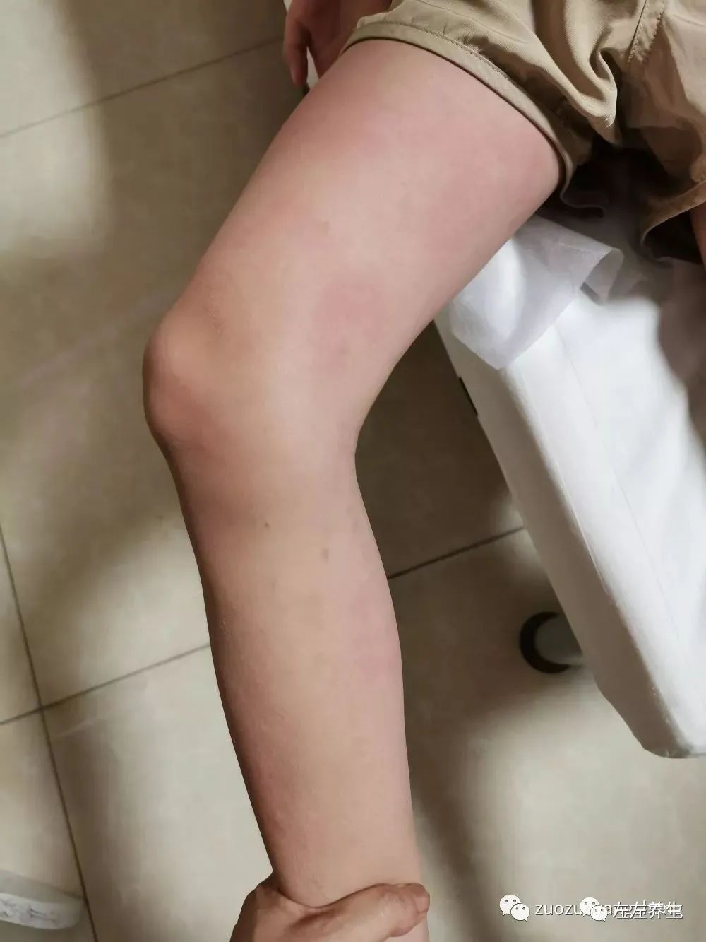 案例分享:突发性过敏全身痒调理案例 案例分享:突发性过敏全身痒调理案例