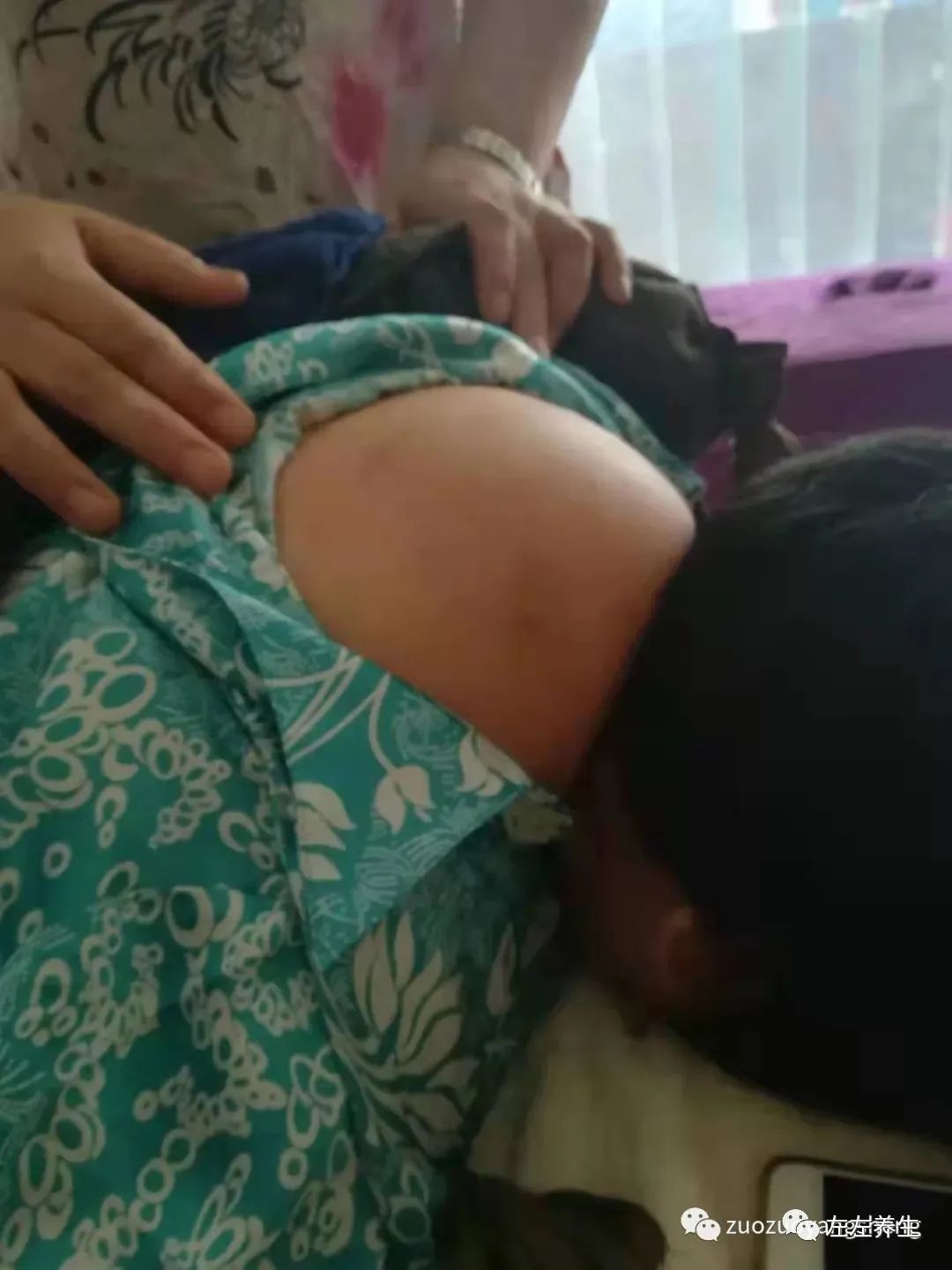 案例分享:双腿无法下蹲以及“富贵包”消除的案例 案例分享:双腿无法下蹲以及“富贵包”消除的案例