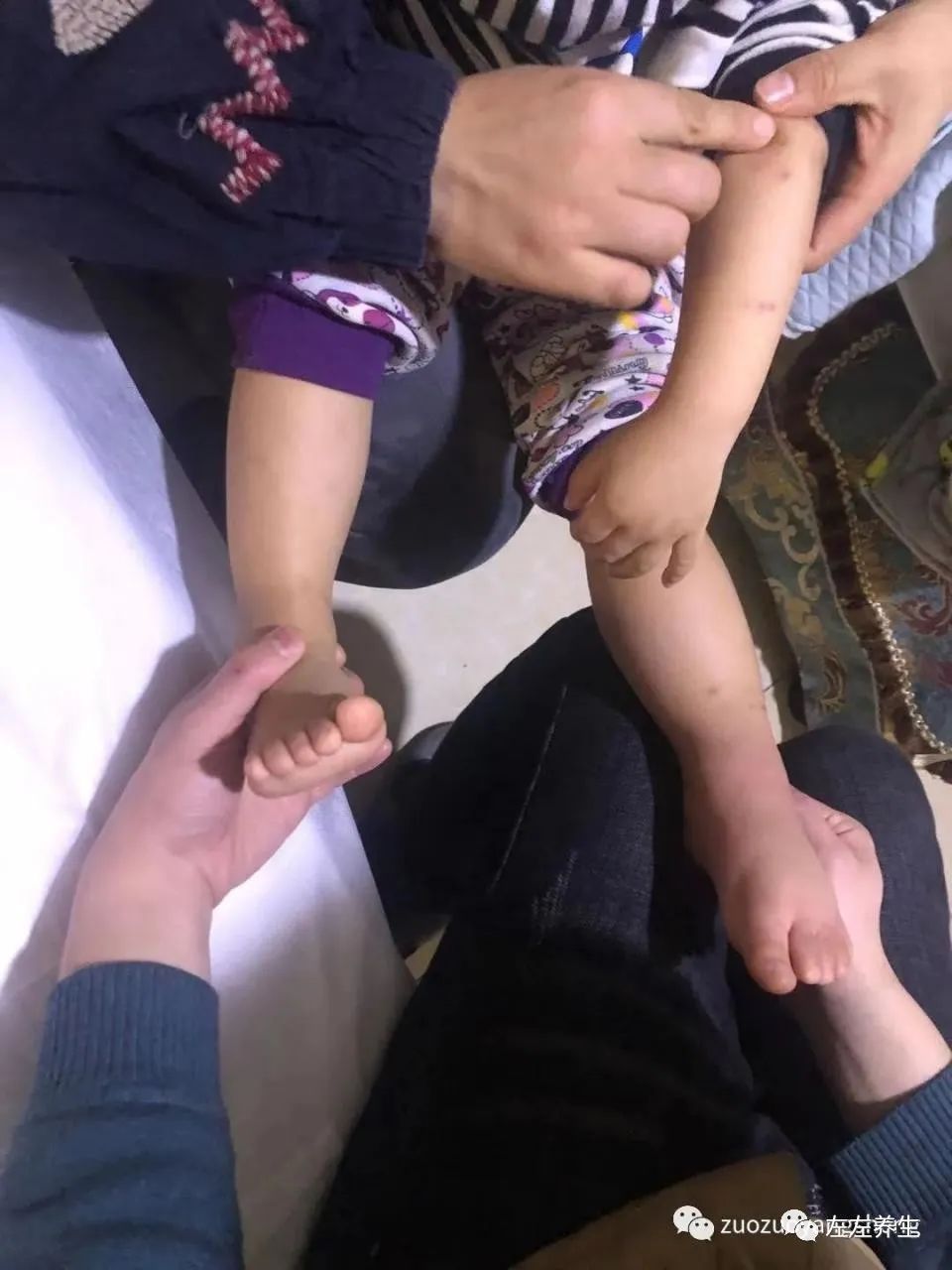 案例分享:原始点调理小孩荨麻疹调理案例 案例分享:原始点调理小孩荨麻疹调理案例