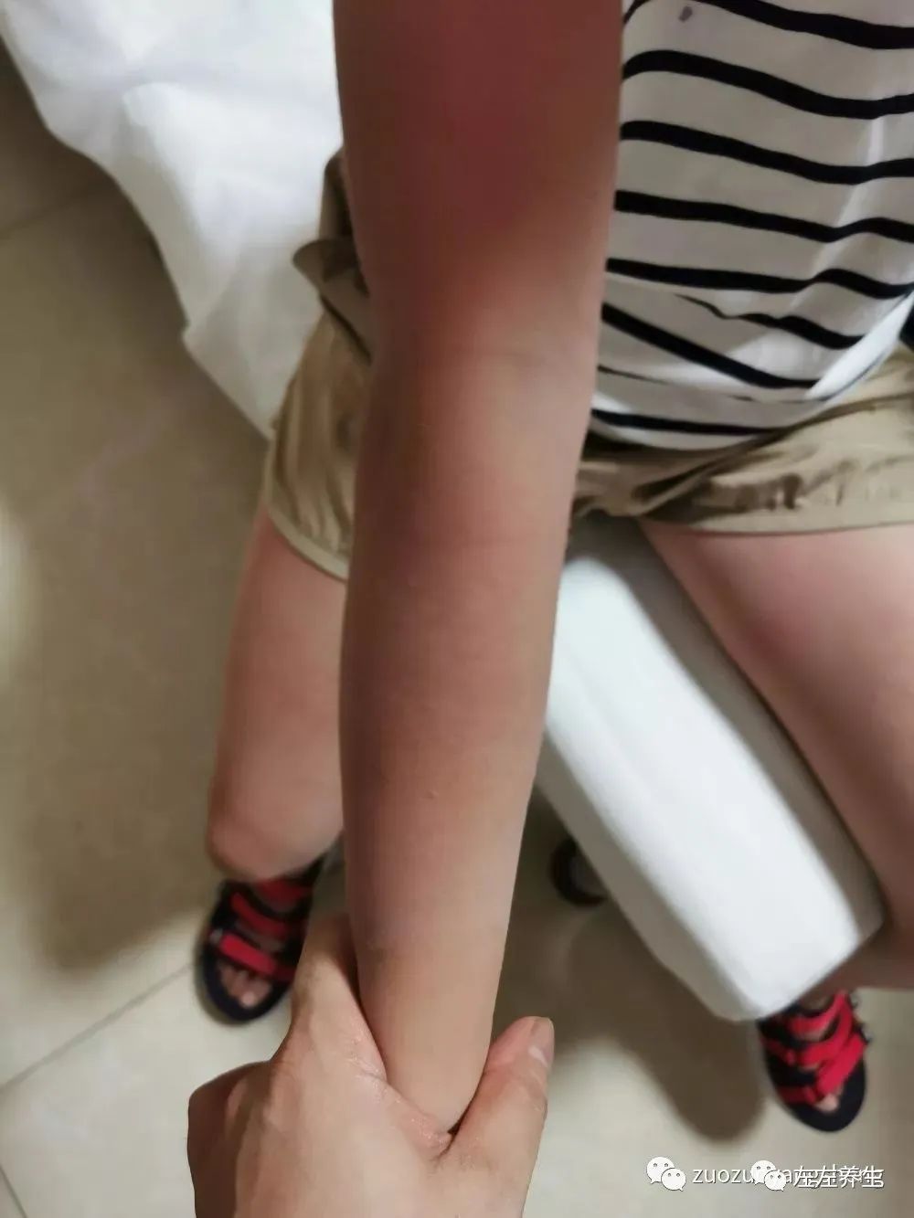 案例分享:突发性过敏全身痒调理案例 案例分享:突发性过敏全身痒调理案例