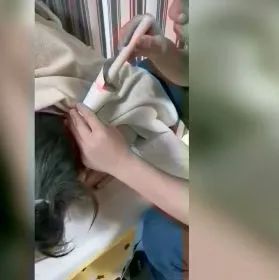 案例分享：调理荨麻疹的好转反应-原始点全球同学网
