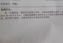 案例分享:车祸导致面瘫调理案例-原始点全球同学网