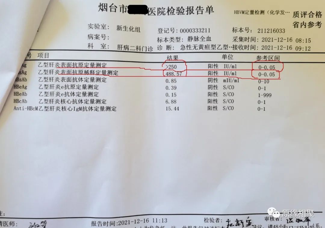 急性乙肝病毒 急性乙肝病毒