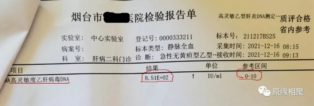 急性乙肝病毒 急性乙肝病毒