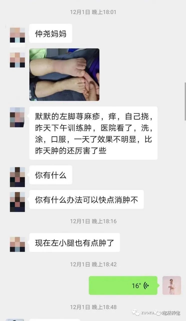 案例分享:原始点调理小孩荨麻疹调理案例 案例分享:原始点调理小孩荨麻疹调理案例