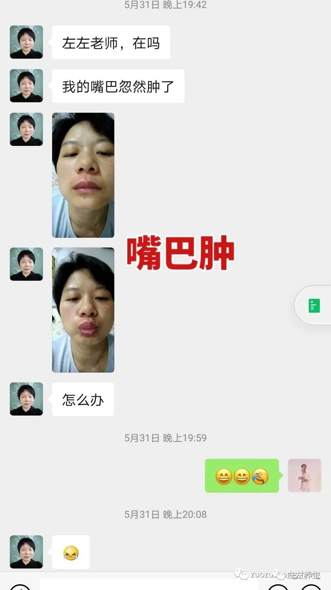 案例分享：调理荨麻疹的好转反应