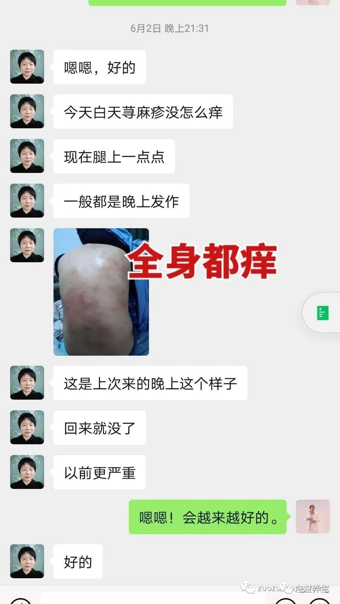 案例分享：调理荨麻疹的好转反应