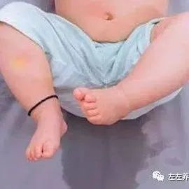 案例分享：小孩尿床的调理案例-原始点全球同学网