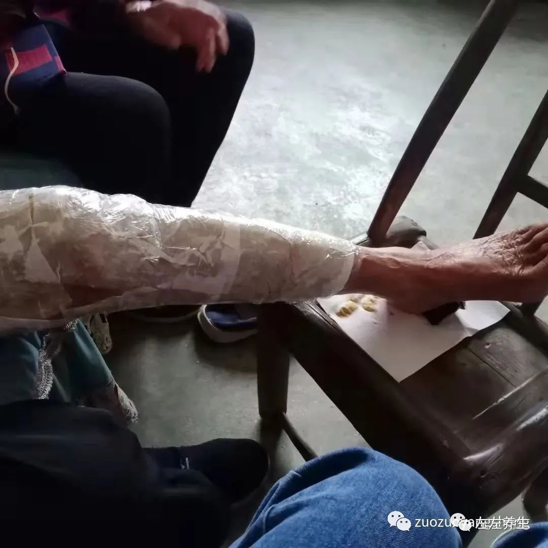 案例分享:85岁老人腿痛、无力,“种”发的案例 案例分享:85岁老人腿痛、无力,“种”发的案例