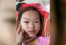 案例分享：兒童十年便秘調理案例-原始點全球同學網