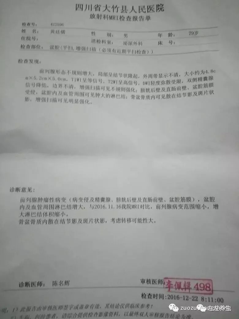 案例分享：前列腺癌的调理案例