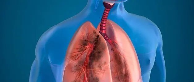案例分享：71岁老人膀胱癌调理案例-原始点全球同学网