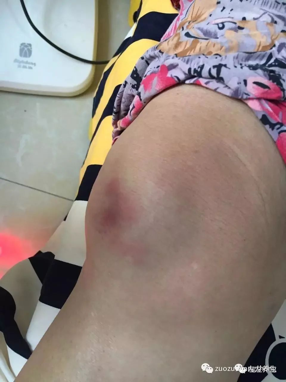 最难度的家人——原始点调理妈妈骨折手术后的康复 最难度的家人——原始点调理妈妈骨折手术后的康复