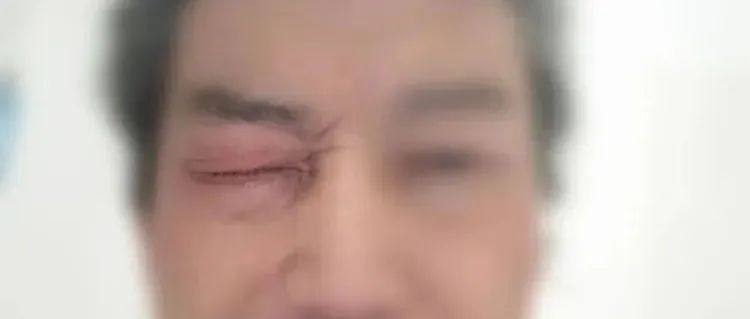 案例分享：视力下降、远视模糊调理案例-原始点全球同学网