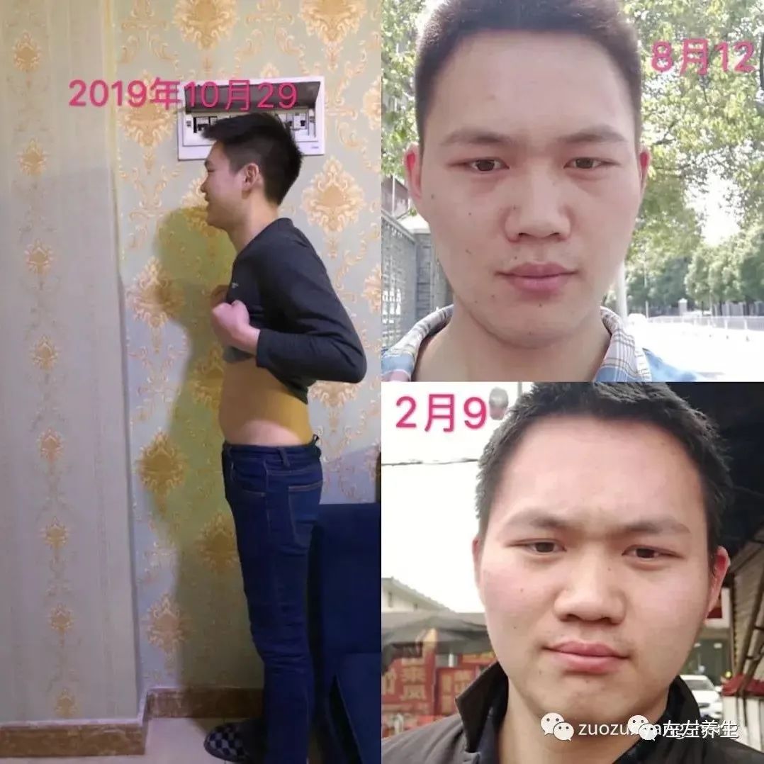案例分享：刘老师十几年手足换季长水痘调理案例-原始点全球同学网
