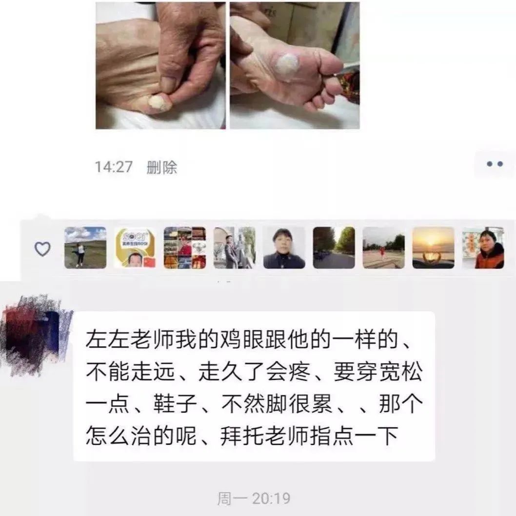 微问答75期：“鸡眼”如何调理？-原始点全球同学网