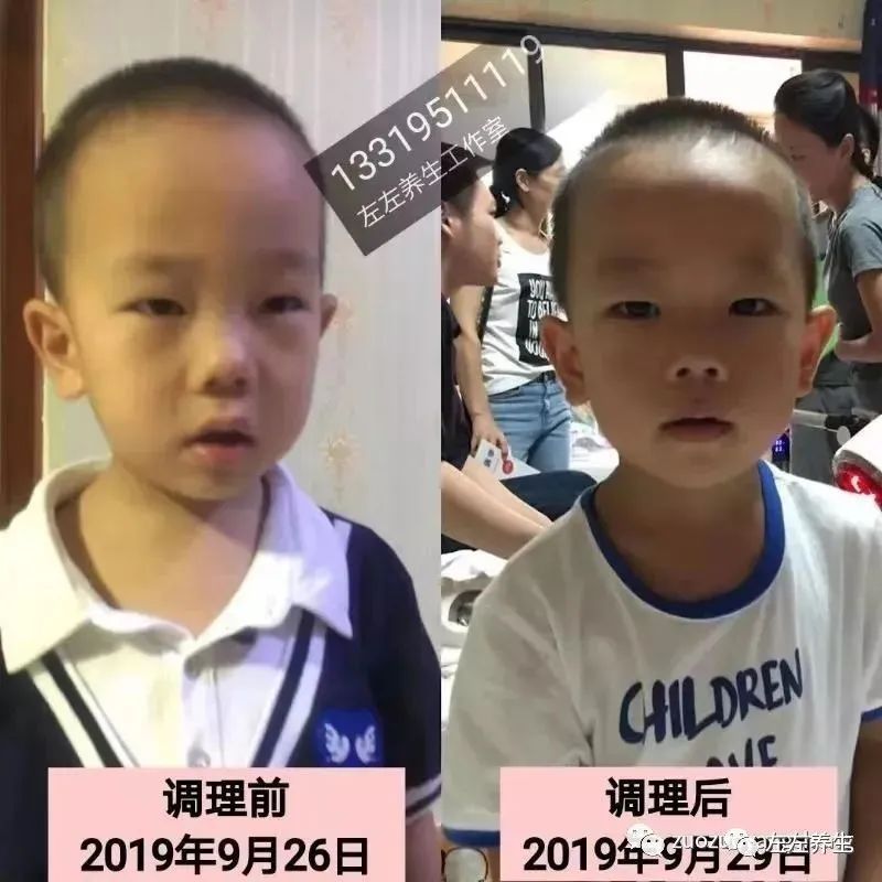 案例分享：小孩反复咳嗽调理案例-原始点全球同学网