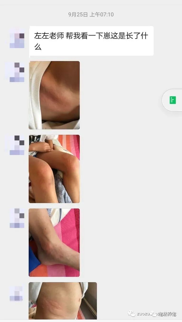 小孩疑似荨麻疹调理案例 小孩疑似荨麻疹调理案例