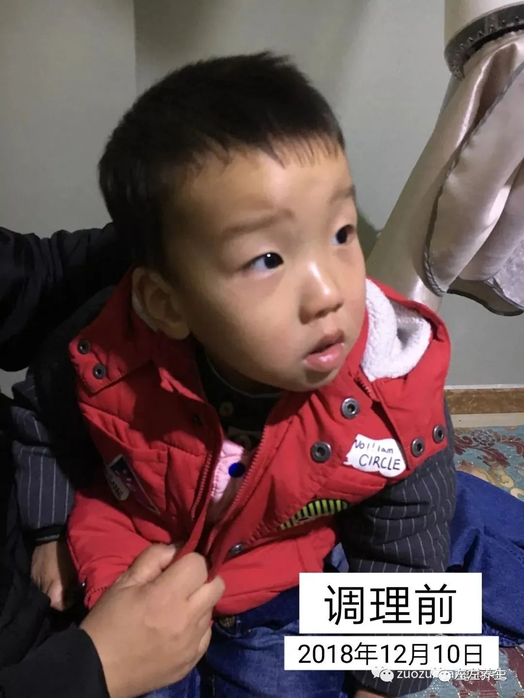 案例分享：摆脱打针吃药痛苦——两孩子哮喘、咳喘、湿疹、鼻塞、体质弱调理案例