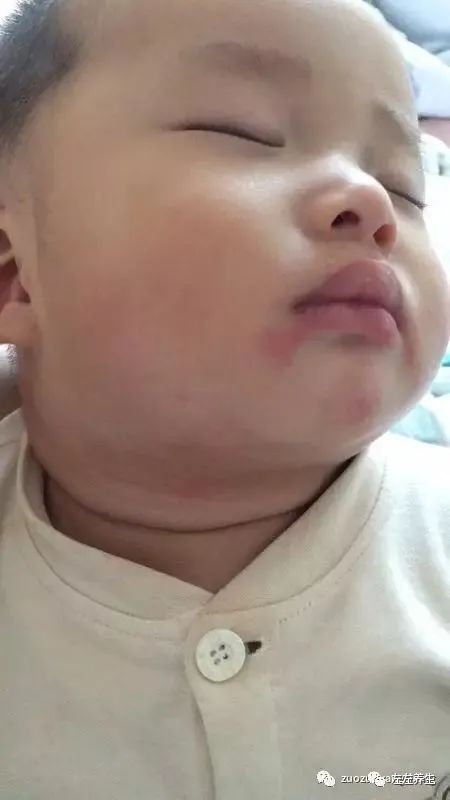 小孩调理过程中所出现的好转反应大总结 小孩调理过程中所出现的好转反应大总结