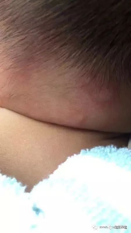 小孩调理过程中所出现的好转反应大总结 小孩调理过程中所出现的好转反应大总结