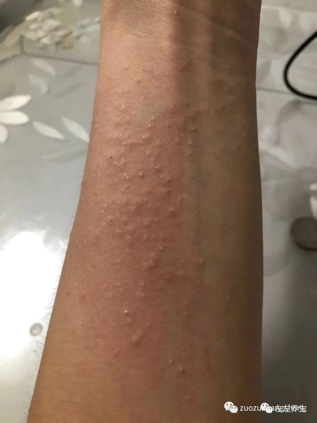 微问答96期：我失眠已经6、7年了，最近一晚上睡眠不足两小时，很是惶恐