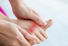 微问答89期:表哥痛风三年了,药物控制,一直得不到根治……-原始点全球同学网