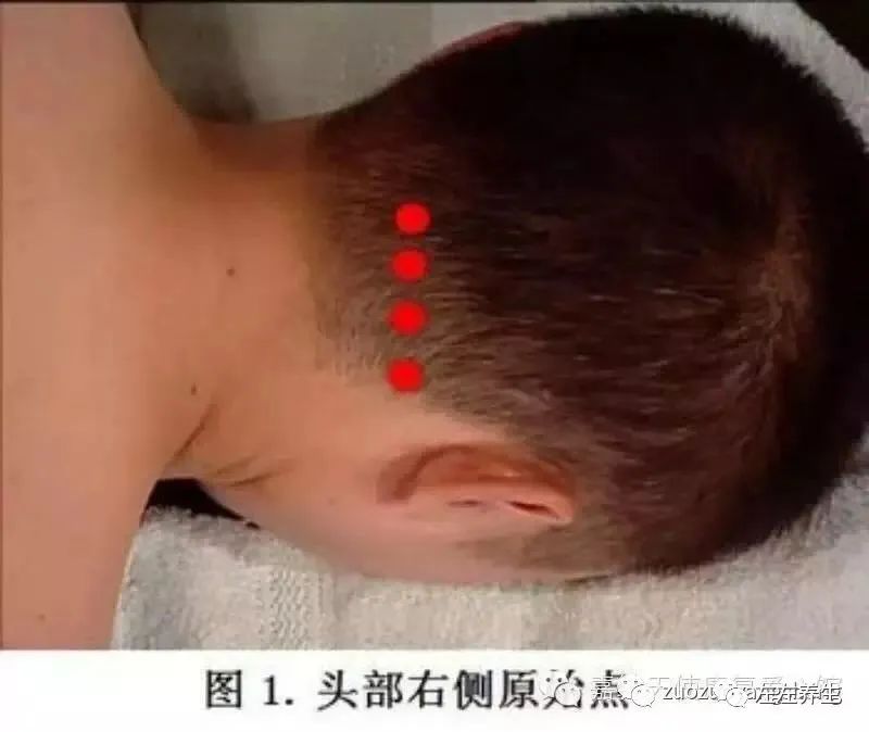 微问答80：痛风好几年了严重的时候痛的走不了路