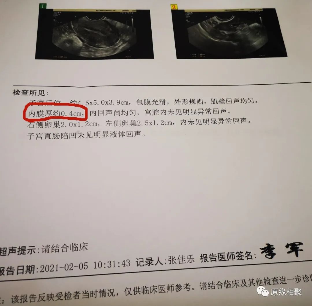 子宫内膜增厚 子宫内膜增厚