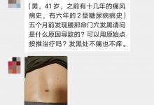 微问答106期:腰部命门穴位发黑,急!急!急!-原始点全球同学网