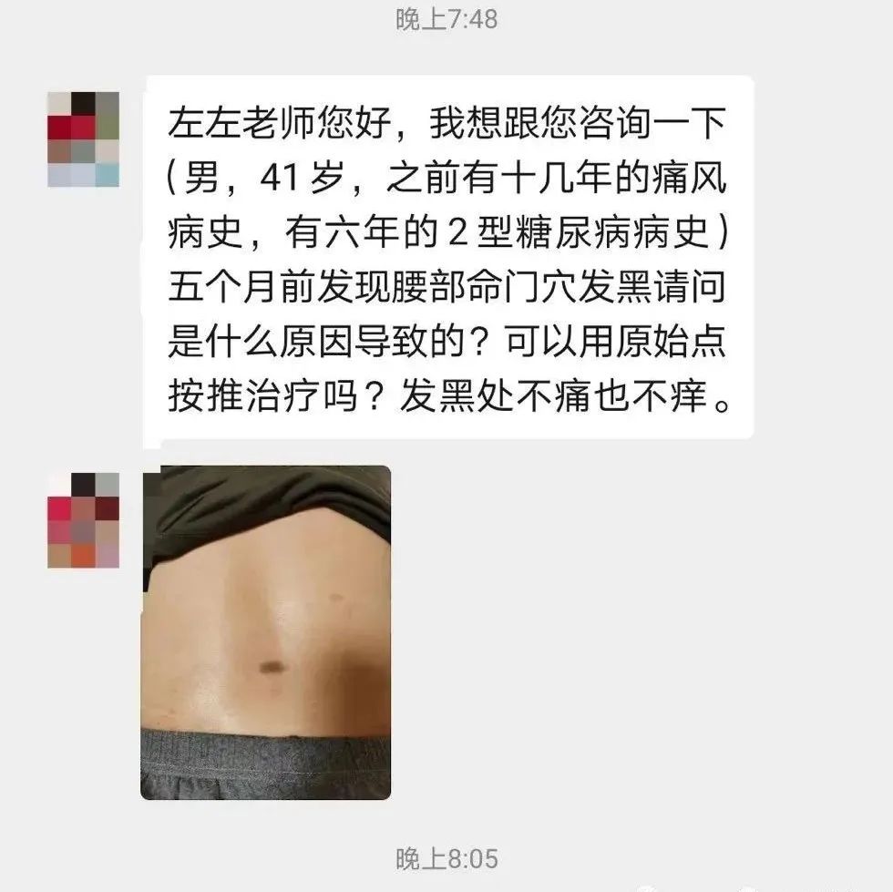 微问答106期：腰部命门穴位发黑，急！急！急！-原始点全球同学网