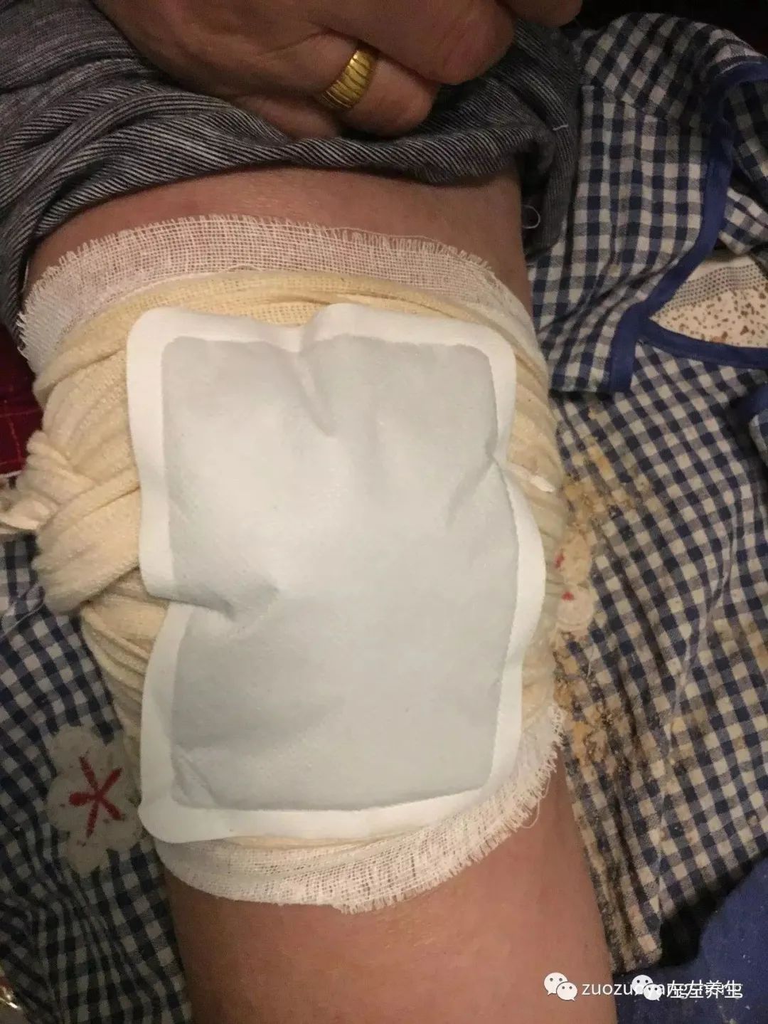 最难度的家人——原始点调理妈妈骨折手术后的康复