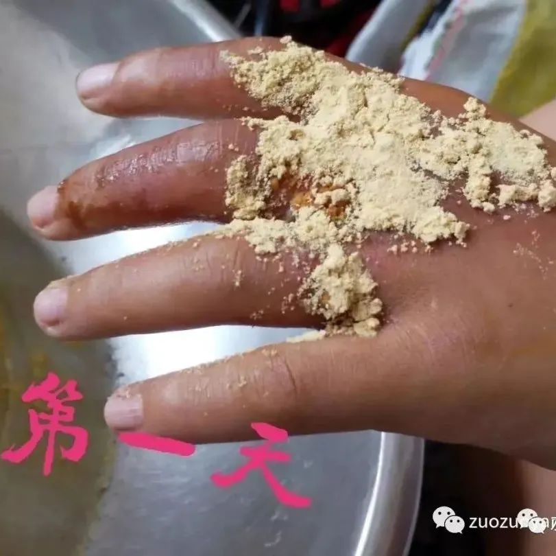 案例分享：小朋友手部烫伤调理案例-原始点全球同学网