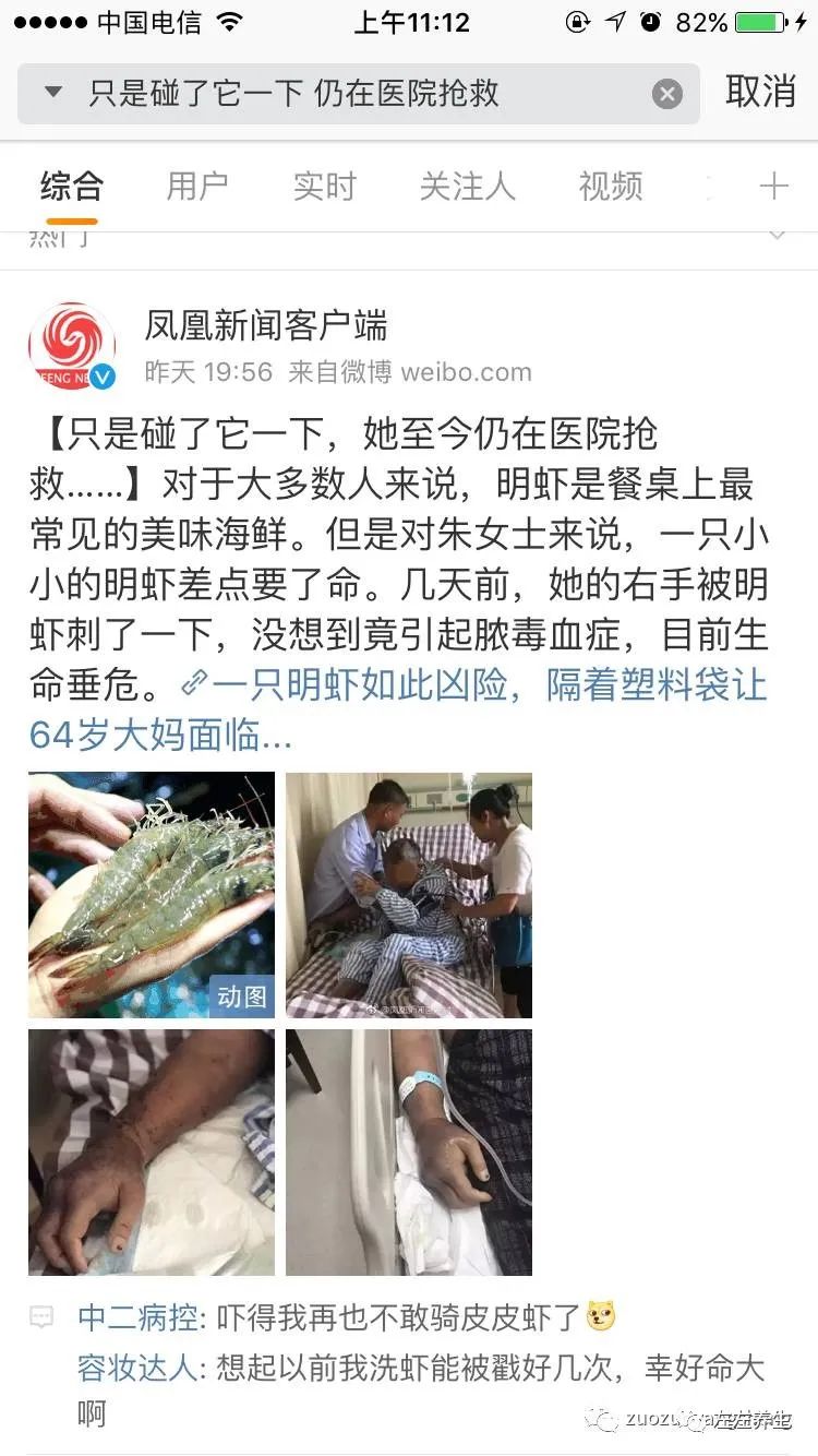 女子被狗咬28天后 丈夫:为何打了狂犬疫苗也没用? 女子被狗咬28天后 丈夫:为何打了狂犬疫苗也没用?