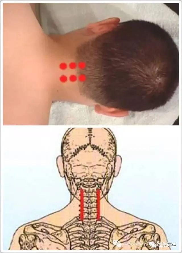 深度剖析：嗓子痛、咳嗽是喝板蓝根菊花茶，还是喝姜茶？