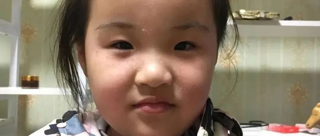 案例分享：摆脱打针吃药痛苦——两孩子哮喘、咳喘、湿疹、鼻塞、体质弱调理案例-原始点全球同学网