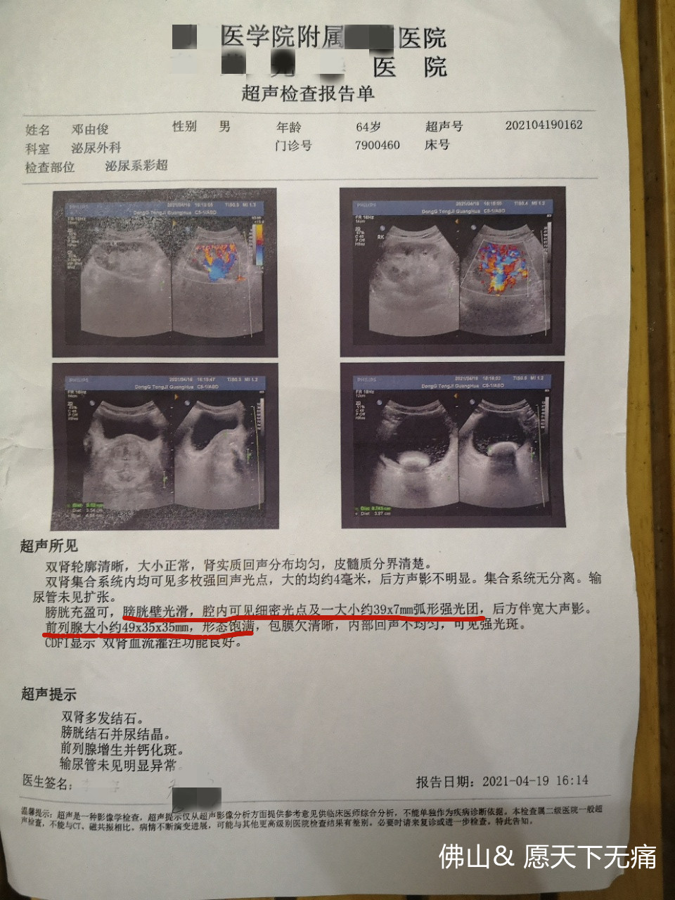 原始点调理尿频 尿急 尿痛 膀胱结石 前列腺增大案例 - 身体 五脏六腑 - 佛山愿天下无痛 原始点调理尿频 尿急 尿痛 膀胱结石 前列腺增大案例 - 身体 五脏六腑 - 佛山愿天下无痛