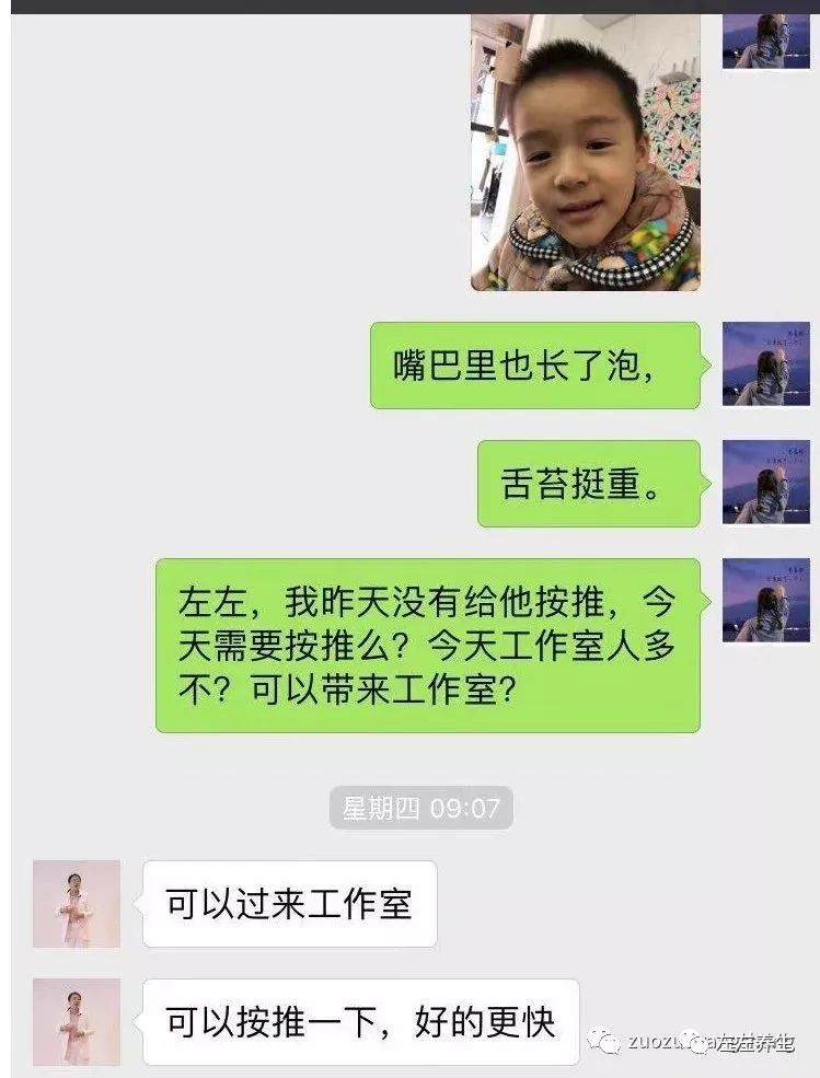 案例分享:5岁小孩水痘调理案例 案例分享:5岁小孩水痘调理案例